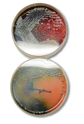 Petri dishes