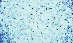 Microsopic view of germs